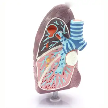 Choré Pľúca Lekárske Model Pľúcnej Anatómia Dýchacieho Systému pre Pacienta Vzdelávania